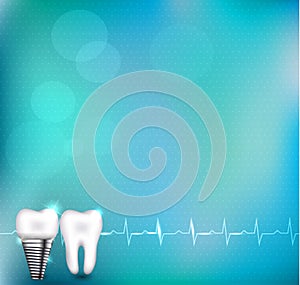 Dental implant and normal tooth
