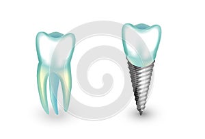 A dental implant. orthodontics