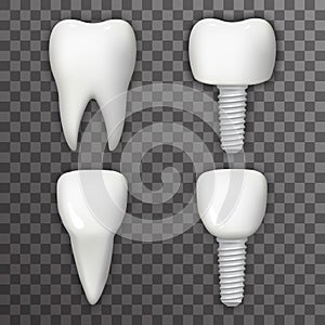 Dental Implant Realistic 3d Tooth Poster Transperent Stomatology Icon Template Background Mock Up Design Vector