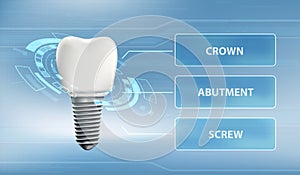 Dental implant with screw and crown. Technology user interface