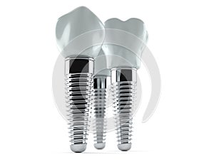 Dental implants