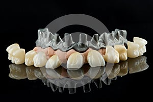Dental implants on a black background