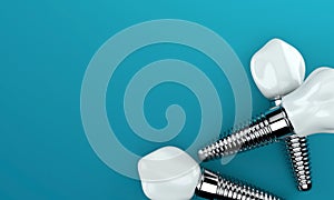 Dental implants on blue background