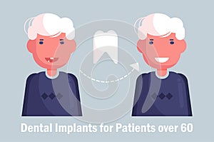 Dental implants for the elderly Vector. Cartoon. Isolated art Man