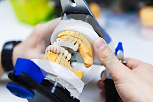 Dental implants. The formation of bite of the teeth. Denture production. Dental laboratory