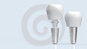 The dental implants for health and medical concept 3d rendering