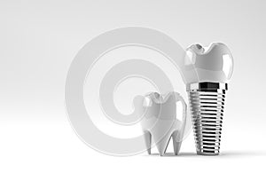 Dental Implants surgery concept 3D Rendering