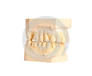 Dental impression 4