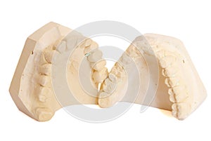 Dental impression 5