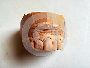 A dental impression