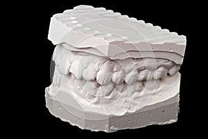 Dental impression chalk model