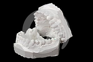 Dental impression chalk model