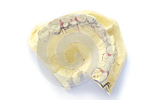 Dental impression model with laboratory design