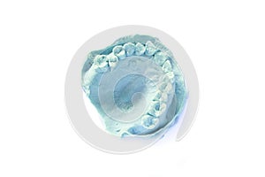 Dental impression model