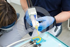 dental impressions, dental prosthetics, a dentist orthopedist holds a model of jaws in his hands and applies polymer