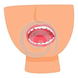 Dental infection icon cartoon vector. Mouth hygiene