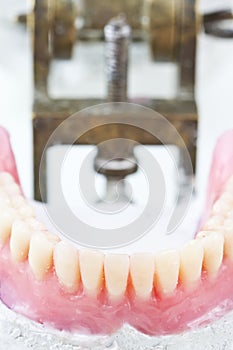 dental inferior wax prosthesis photo