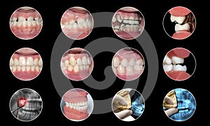 Dental infographic orthodontics collection