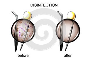 Dental instruments before and after sterilization