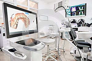 Dental intraoral scanner in modern clinic.