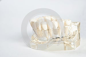 Dental jaw model against white background with copy space