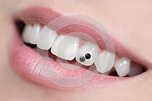 Dental jewelry