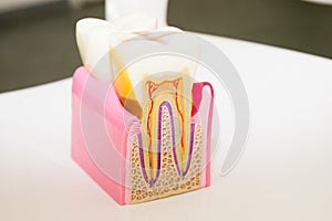 Dental model anatomy of the tooth cross-section dentist concept for education