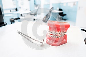 Dental model with braces - Teeth orthodontic dental model with dental braces in dentist clinic