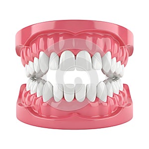 Dental model displaying teeth alignment