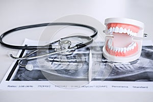 Dental model and equipment on tooth x-ray film and stethoscope u