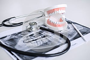 Dental model and equipment on tooth x-ray film and stethoscope used in the treatment of dental and dentistry by dentist photo