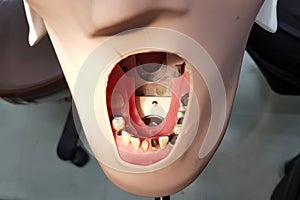Dental model in phantom head