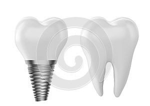 Dental model of a tooth, illustration as a concept of dental examination of teeth. photo