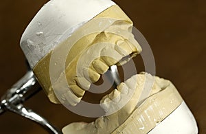 Dental Mold