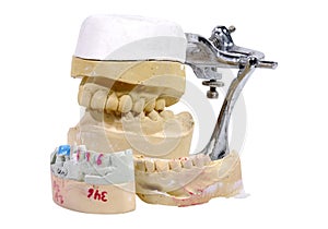 Dental Mold photo