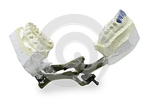 Dental Molds of Human Teeth isolated on white