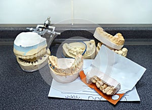 Dental molds for prosthetic teeth