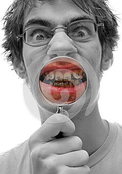 Dental Mouth Braces Inspection