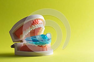 Dental mouth guard for bruxism with a mock-up of a dental jaw on a yellow background. Concept for treatment and