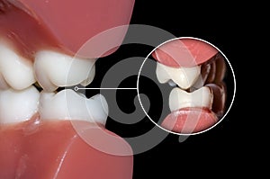 Dental occlusion molars teeth close up photo