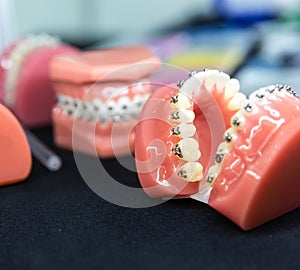 Dental or orthodontic tools, denture closeup