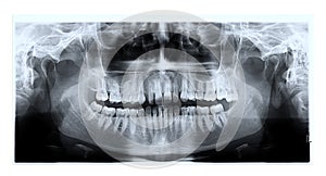 Dental panoramic x-ray film