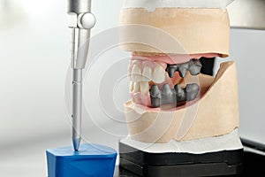 Dental photo of the articulator and two dental prostheses in the occlusion for accuracy and measurements