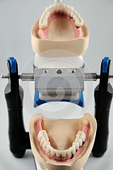 Dental photo of the articulator and two dental prostheses in the occlusion for accuracy and measurements