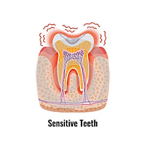 Dental Problem Poster