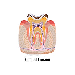 Dental Problem Poster