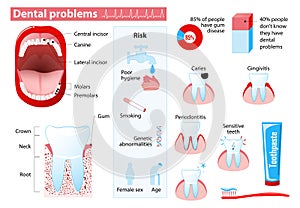 Dental problems