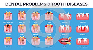 Dental Problems Diseases Infographic Set