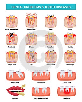 Dental Problems Diseases Infographic Set