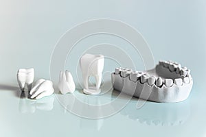 dental prostheses from the 3d printer